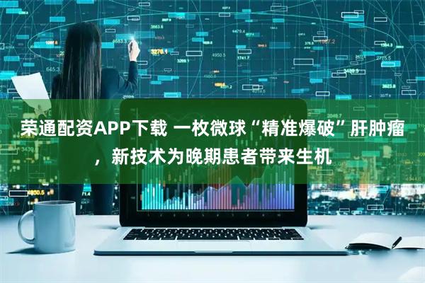 荣通配资APP下载 一枚微球“精准爆破”肝肿瘤,新技术为晚期患者带来生机